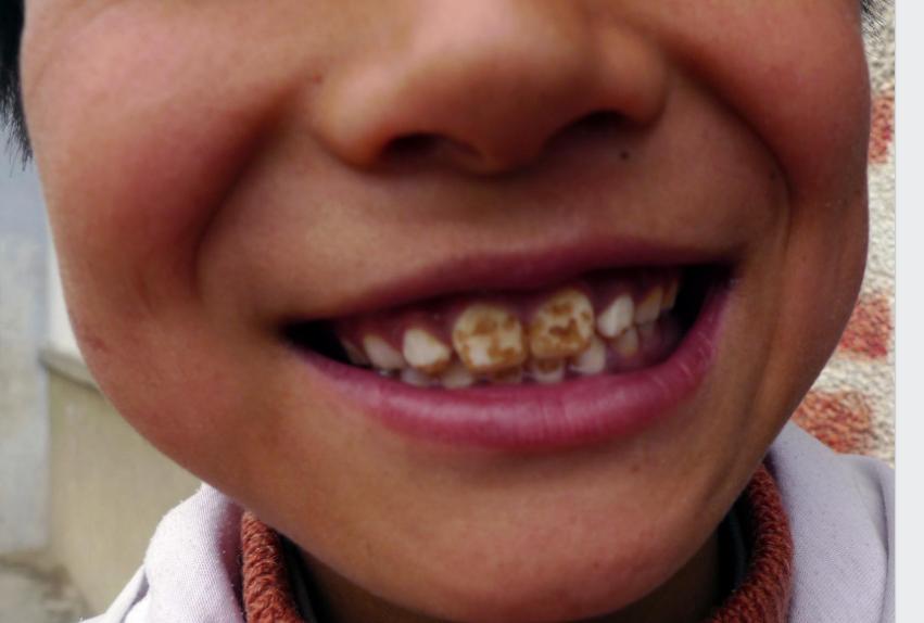 刷屏了（世界杯决赛）哈萨克斯坦较量韩国比分冲冠形势-深度剖析